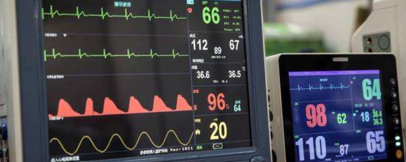 监护器上的显示线ECG(监护器上的显示线都代表什么)