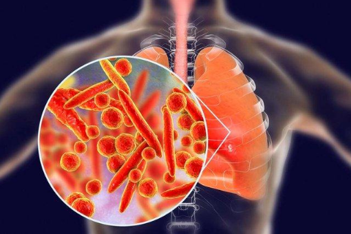 支原体肺炎感染一次还会再感染吗2