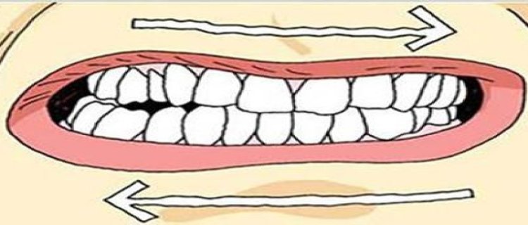 晚上睡觉为什么会磨牙 晚上磨牙是什么原因